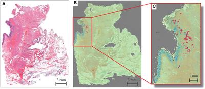 Size and depth of residual tumor after neoadjuvant chemoradiotherapy in rectal cancer – implications for the development of new imaging modalities for response assessment